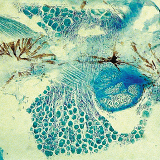 This photomicrograph shows spinal ganglion cells, neurites and stellate chromatophores (CC-BY-NC-ND 2.0) Franck Genten / flickr.com